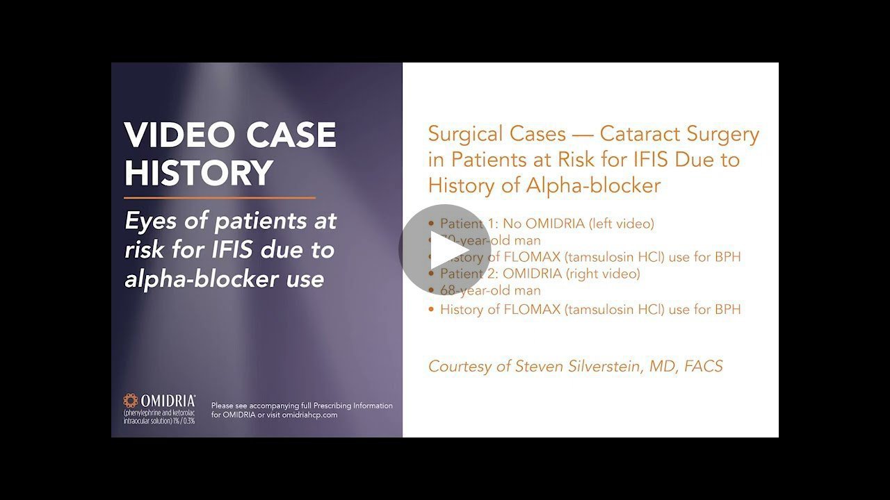 Thumbnail of IFIS-Risk Patient video